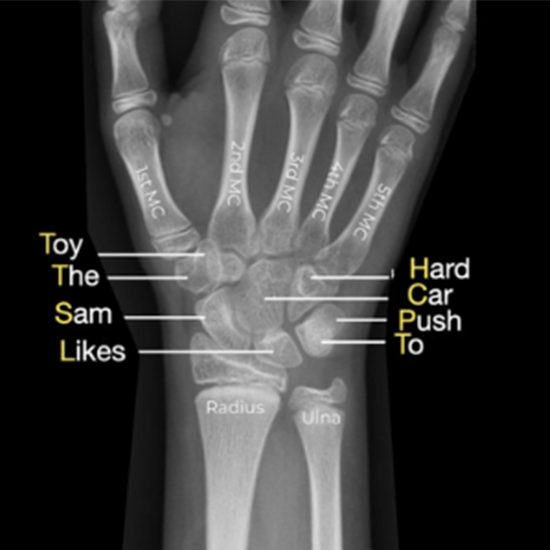 X-Ray Wrist AP View